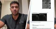 Tommy Fury Shows Hospital Scans To Prove Withdrawal Is Genuine In New Video Post